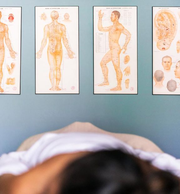 Four posters showing acupuncture points on the human body
