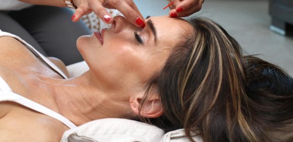 A woman receiving acupuncture treatment